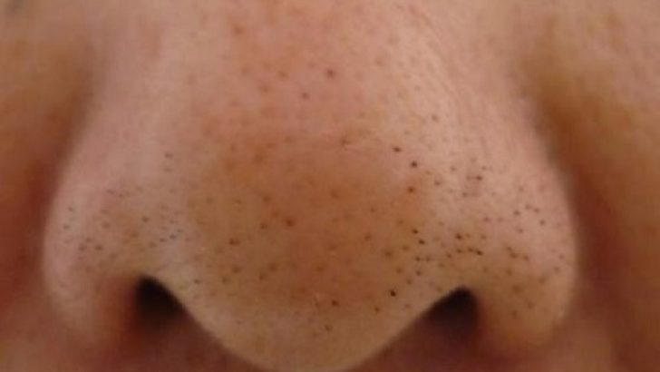 About Nose Pore