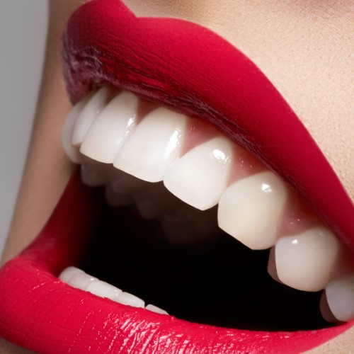 Teeth Whitening Techniques